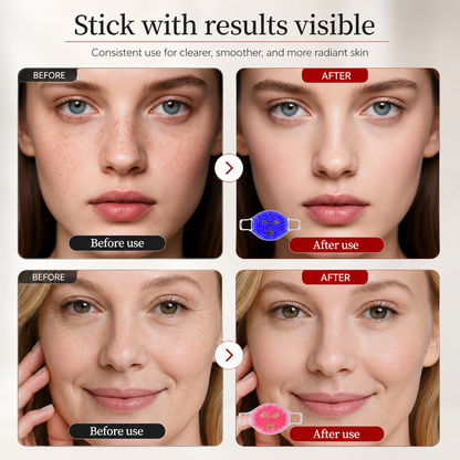 LumiAura Pro LED Face Mask